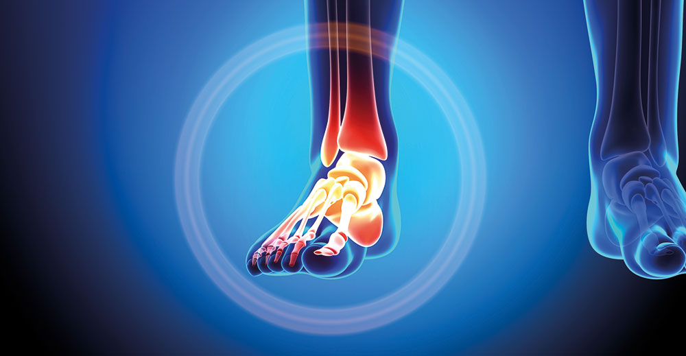 Orthopaedic Surgery - Foot and Ankle | Specialities & Treatments at Parkside Suite Heatherwood