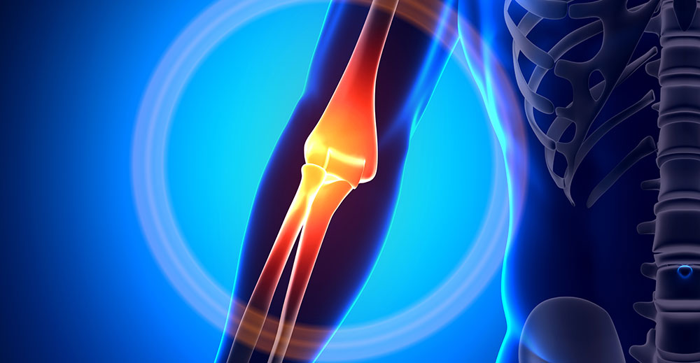 Tennis Elbow | Specialities & Treatments at Parkside Suite Heatherwood